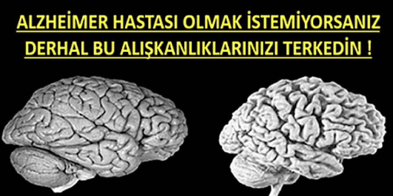 Gelecekte Sizde Alzheimer Hastası olmak istemiyorsanız bunları terk edin