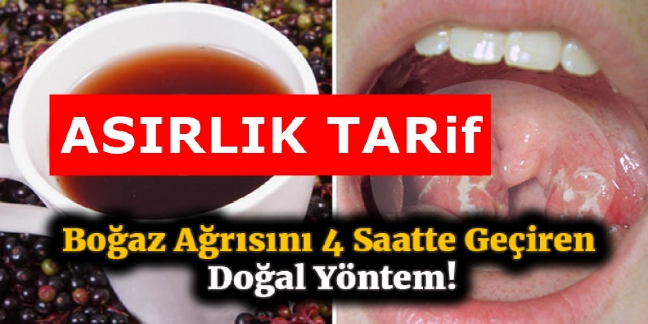 İltihaplı bademcikleri ilaç kullanmadan iyileştiren bitkisel kür