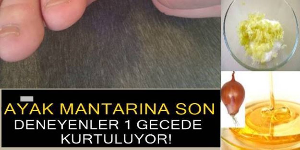Ayak Mantarını 1 gecede yok etmek için bu doğal karışımı deneyin