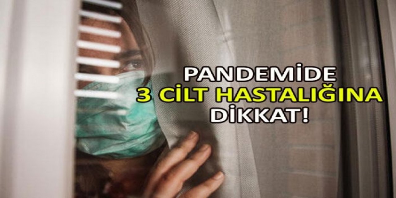 Salgın Döneminde bu 3 cilt hastalığı sizi etkileyebilir mutlaka önlem alın