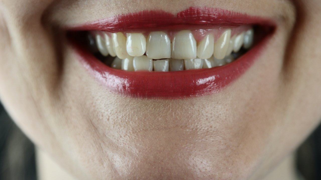 Dişlerinizi mahveden 17 alışkanlık
