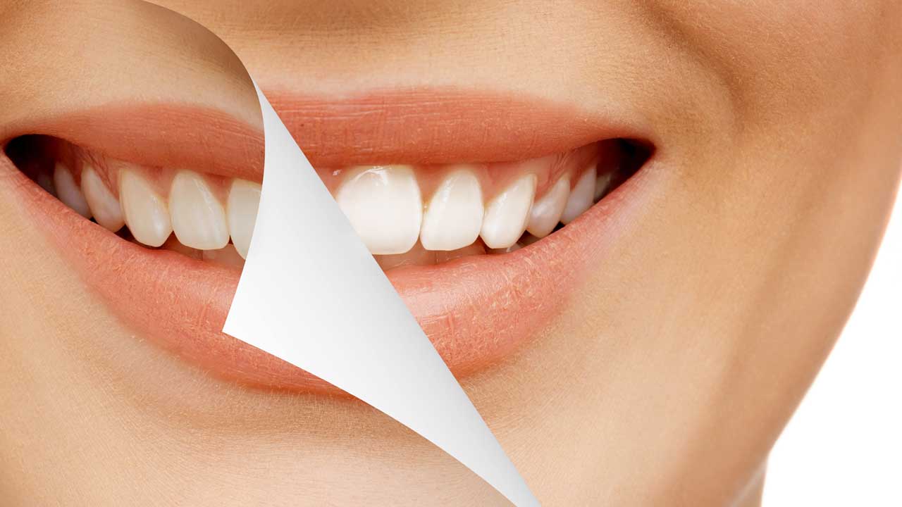 Dişlerinizi ne sıklıkta beyazlatmalısınız?
