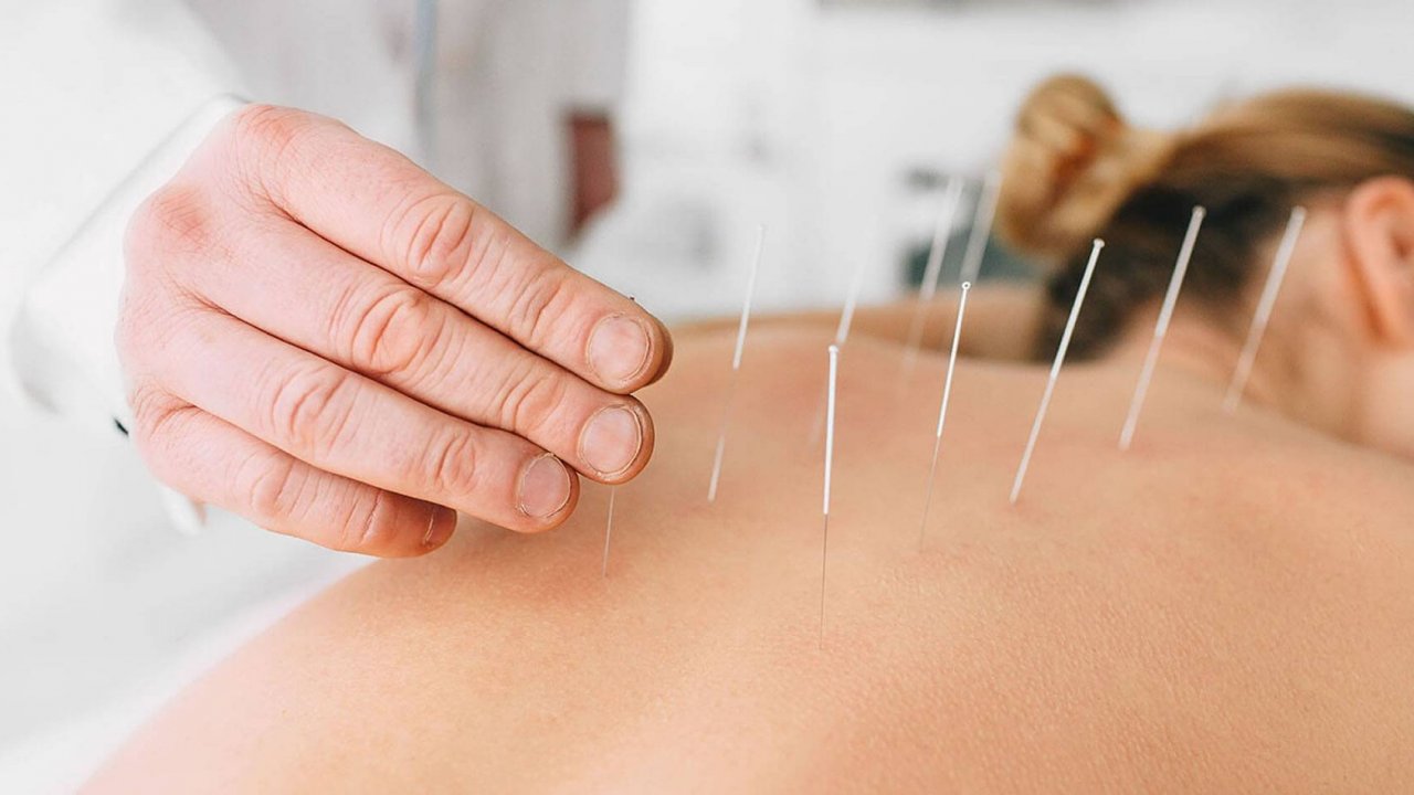 Geçmeyen boyun ağrıları akupunktur tedavisiyle son buldu