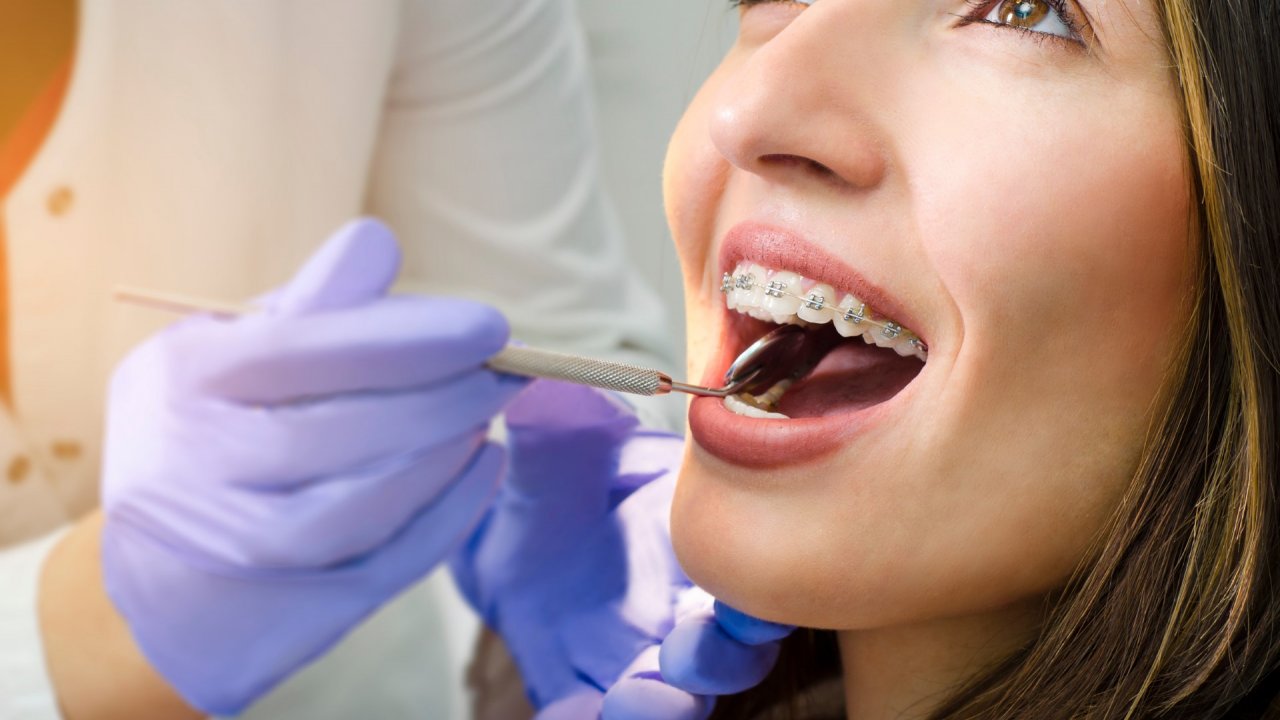 "Ağız ve diş sağlığı sorunları öz güven problemlerine yol açabiliyor"