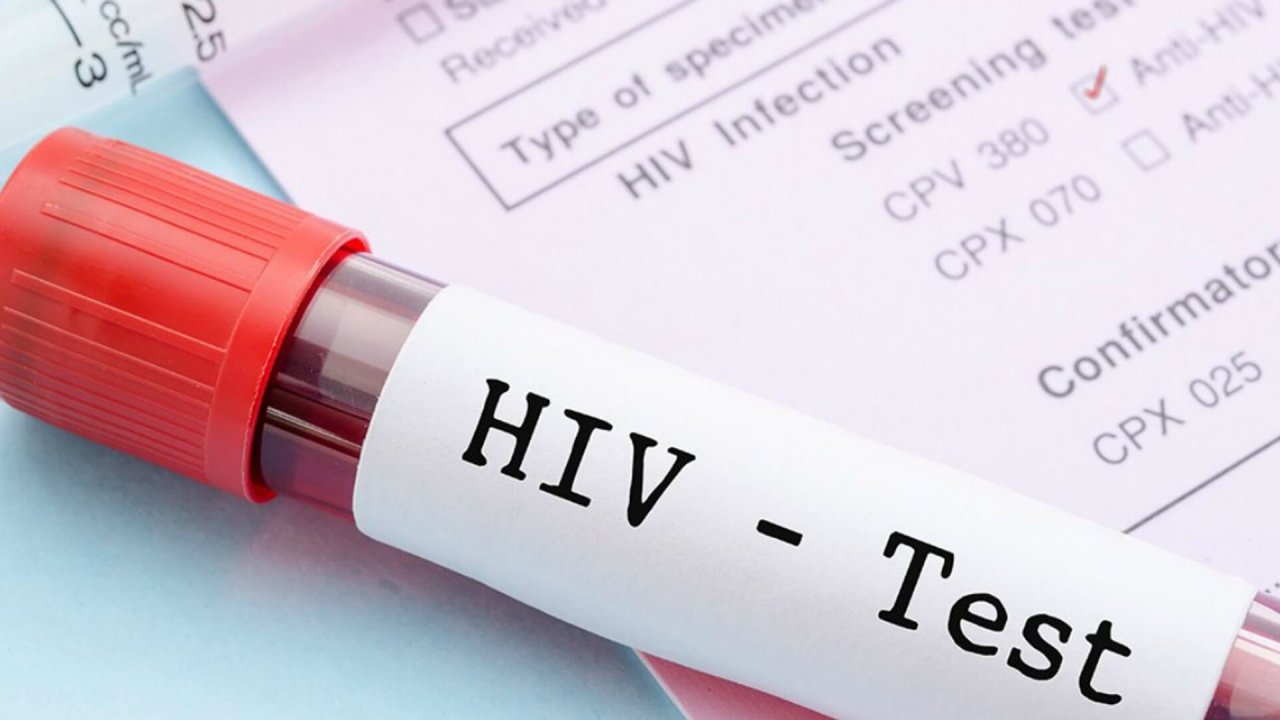 HIV Tedavisinde Devrim Yaratan Yeni Yöntem Tanıtıldı