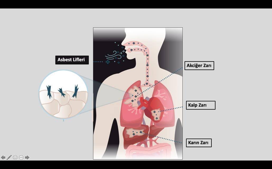 Asbest Maruziyeti ve Mezotelyoma: Ölümcül Tehlikenin Farkında mısınız?